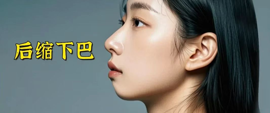 颜值之外，下颌后缩隐藏的健康真相！