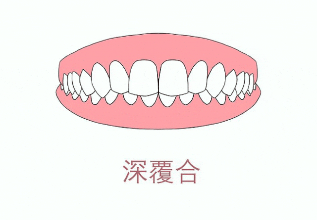 1.gif