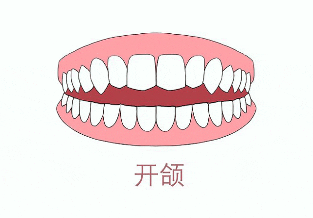 3.gif