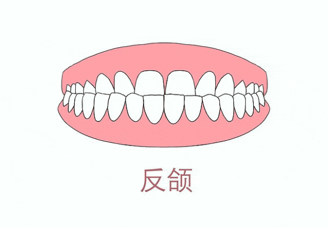 2.gif